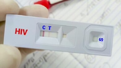 درمان «ایدز» رایگان است/ ویروس HIV قابل کنترل است به شرط درمان