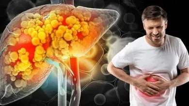 بالاخره با کبد چرب تخم‌مرغ بخوریم یا نه؟