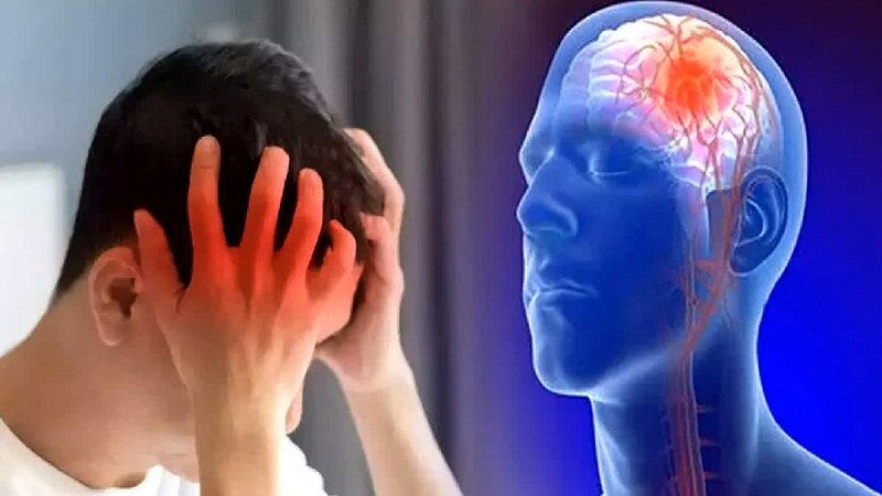 این علائم سکته مغزی را با بیماری‌های دیگر اشتباه نگیرید؛ زمان مهم است